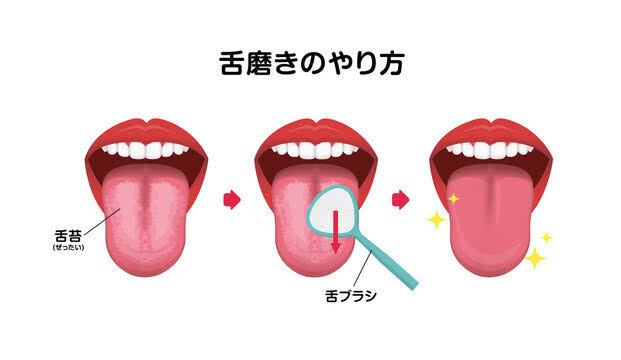 舌磨きについて 画像