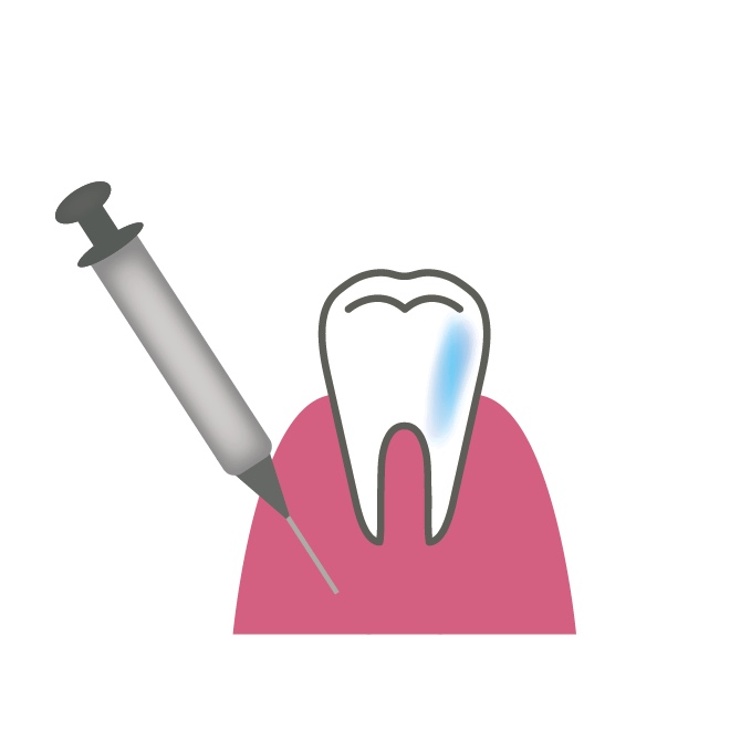 歯科麻酔について💉 画像