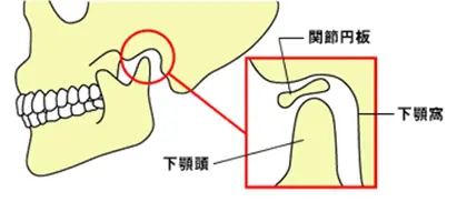 顎関節症について 画像