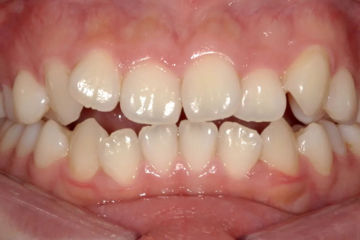 Before Image