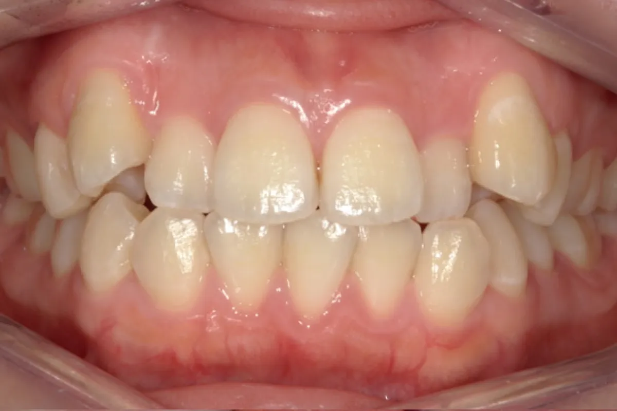 Before Image