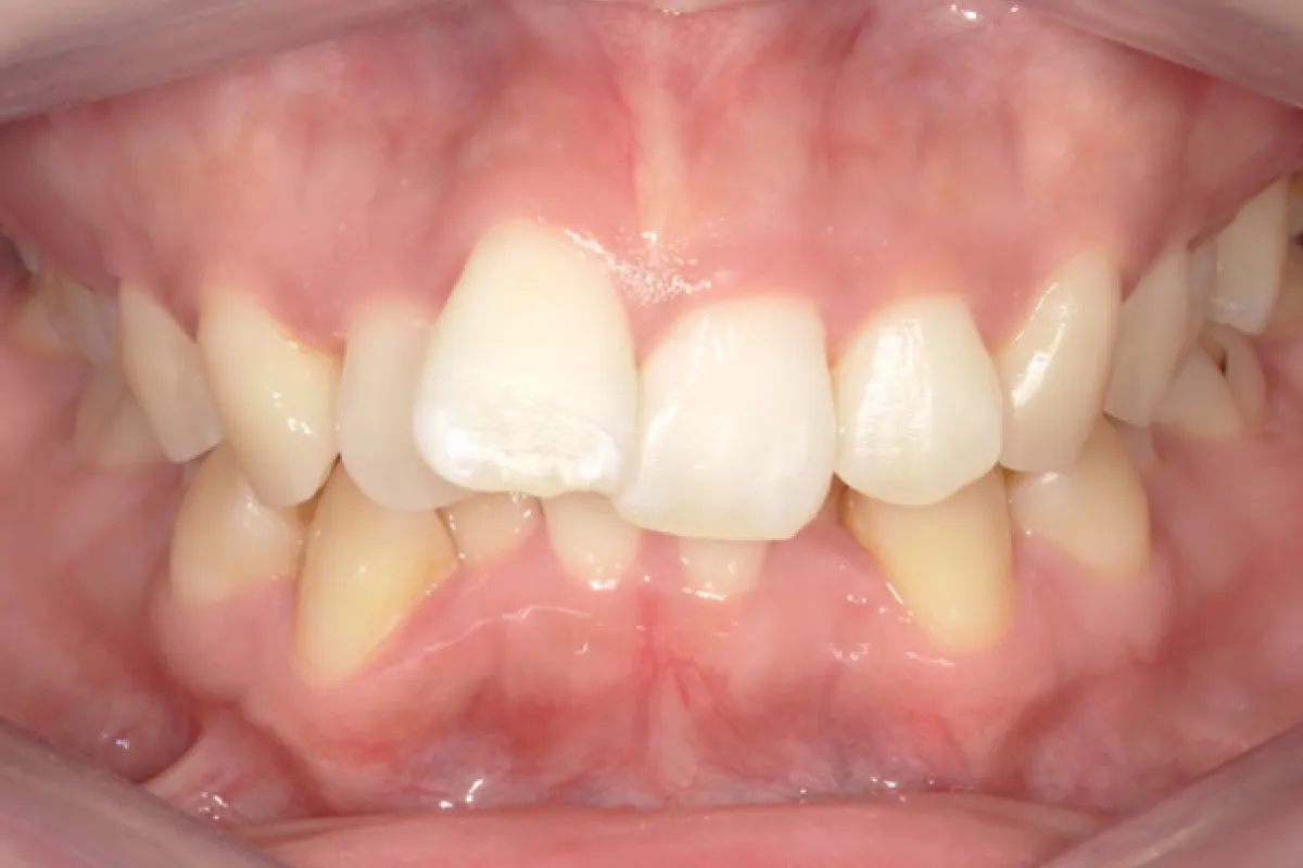 Before Image