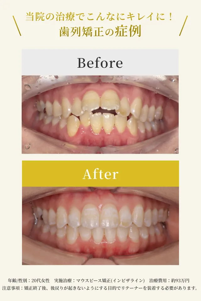 町田で矯正歯科は、あなたに合う矯正メニューをご提案する町田エス歯科