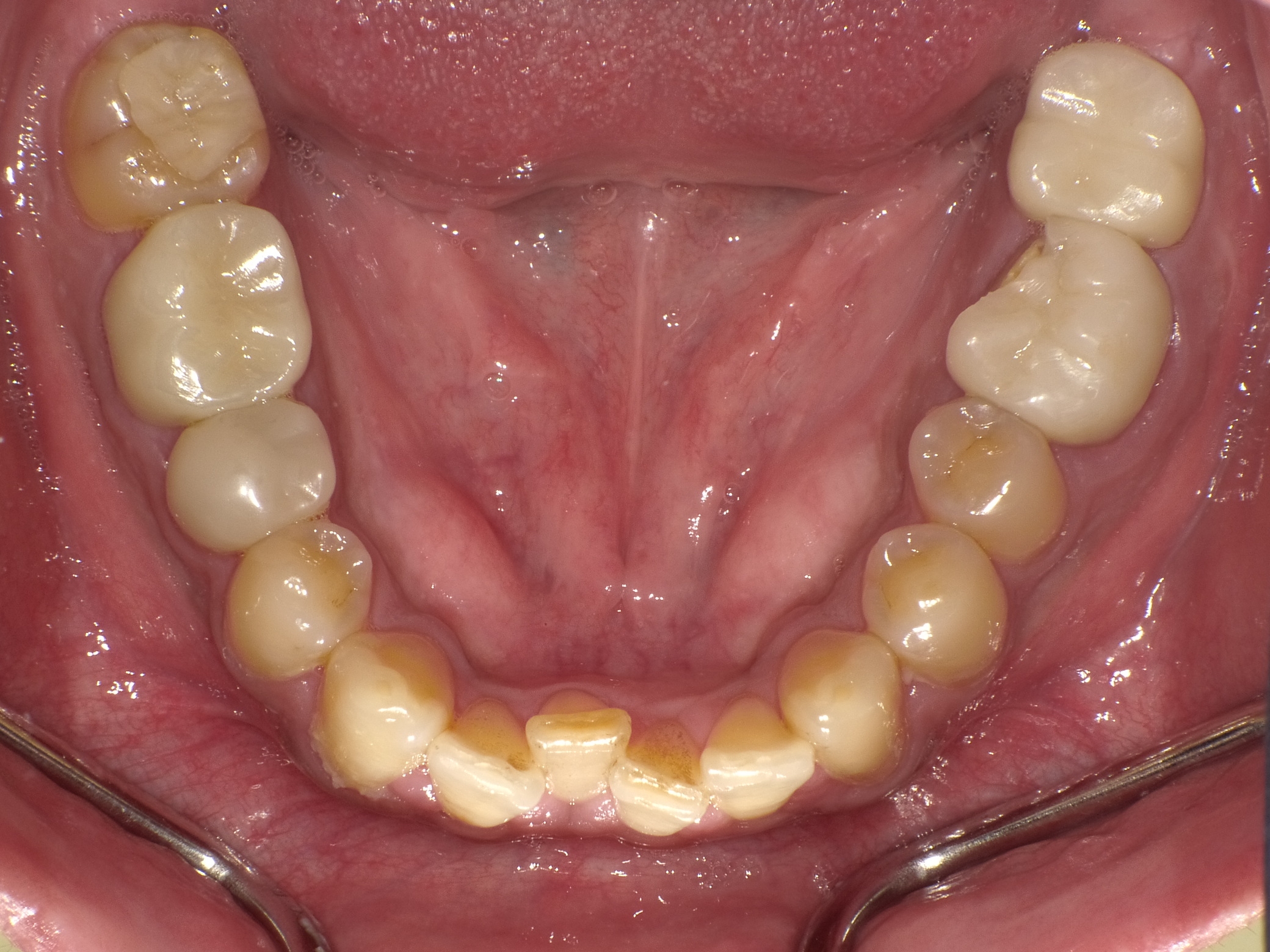 Before Image