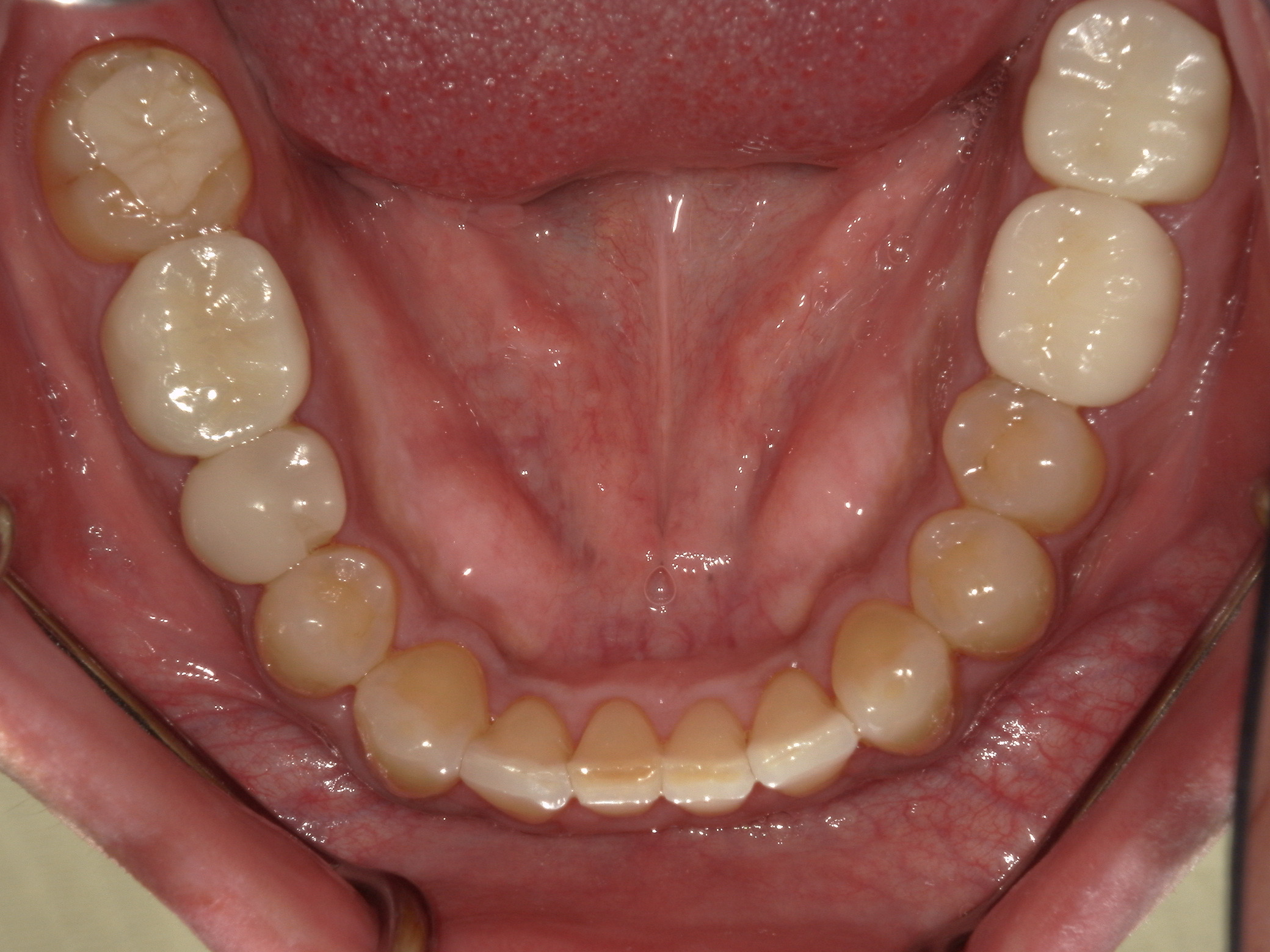 After Image