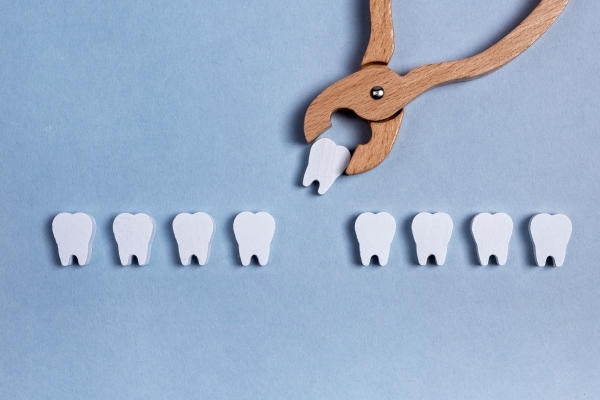 歯列矯正で抜歯は必須?後悔しないための「抜く・抜かない」の判断基準 画像