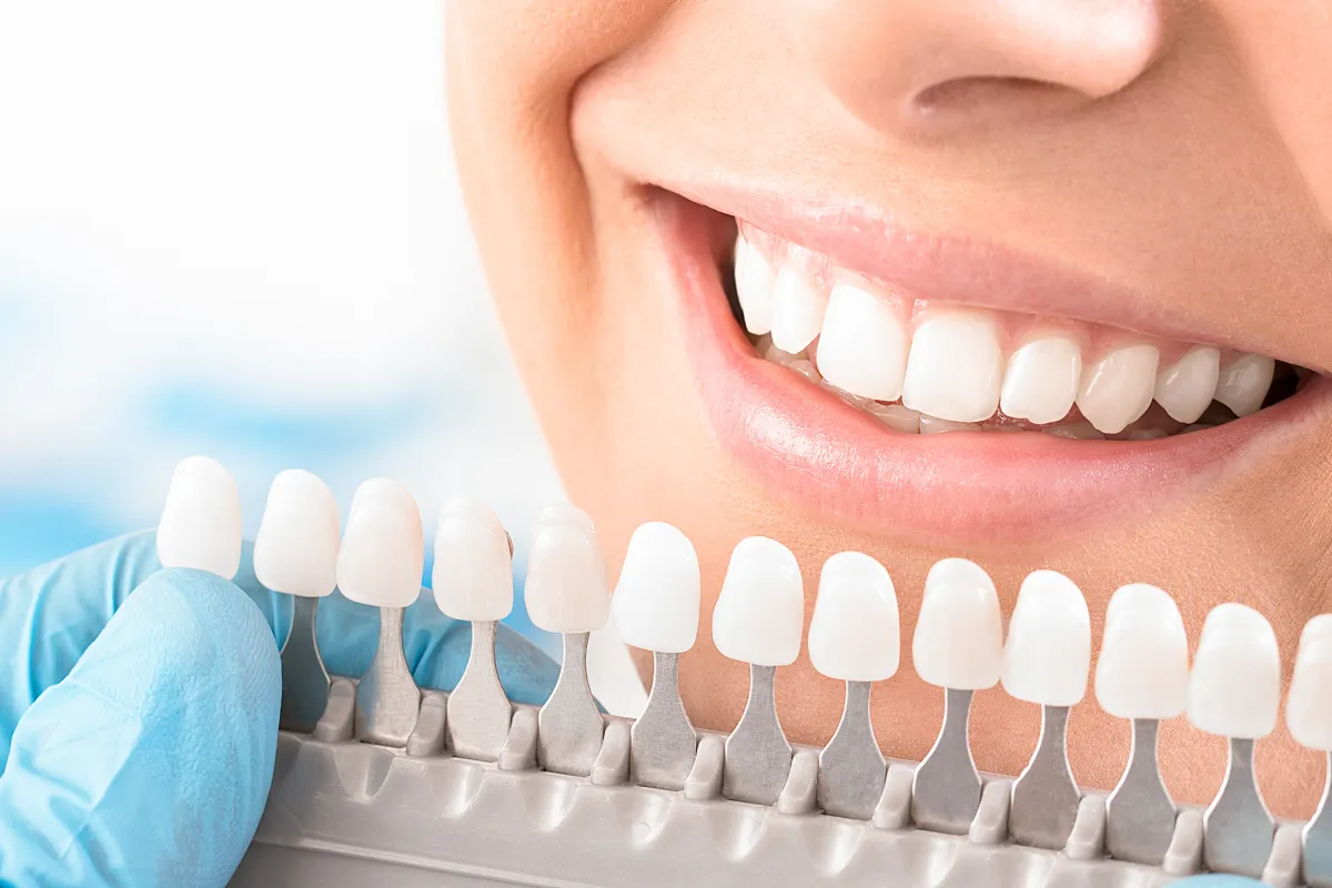 ホワイトニング後のイメージ画像